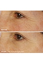 view 2 of 4 Bright Eyes Depuffing & Brightening Eye Gels in 