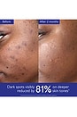 view 3 of 9 Vinoperfect Dark Spot Serum in 
