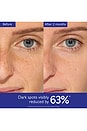 view 4 of 9 Vinoperfect Dark Spot Serum in 