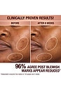 view 5 of 9 Dark Spot Correcting Radiance Recovery Serum 10ml in 