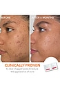 view 3 of 8 Dr Dennis Gross Smooth, Radiant, Firm Kit in Normal / Oily Skin