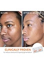 view 4 of 8 Dr Dennis Gross Smooth, Radiant, Firm Kit in Normal / Oily Skin