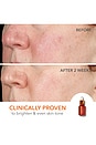 view 5 of 8 Dr Dennis Gross Smooth, Radiant, Firm Kit in Normal / Oily Skin