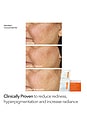 view 7 of 10 Boost Collagen, Brighten & Firm Set in 