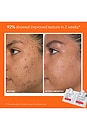 view 4 of 7 Extra Strength Brightening Kit in 