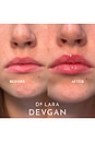 view 5 of 5 Vermillion Lip Plump in 