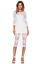 view 1 of 3 Lace Midi Dress in Soft White