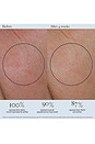 view 4 of 9 Tightening Detox Mask in 