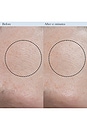 view 3 of 8 RESURFACING ENZYME POLISH リサーフェシングエンザイムポリッシュ in 