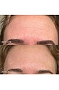 view 2 of 6 Forehead Occlusion Patch in 