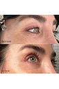 view 2 of 6 Occlusion Eyes & Mouth Patches in 