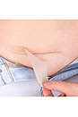 view 4 of 5 Scar Occlusion Patch in 