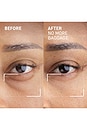 view 3 of 5 CREMA PARA LOS OJOS NEEDLES NO MORE in 