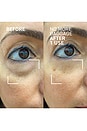 view 4 of 5 CREMA PARA LOS OJOS NEEDLES NO MORE in 