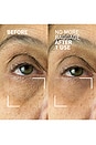 view 5 of 5 CREMA PARA LOS OJOS NEEDLES NO MORE in 