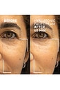 view 2 of 7 Needles No More Hyaluronic Face Cream in 