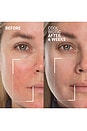 view 2 of 6 Cool Biotic Prebiotic Redness Relief Cream in 