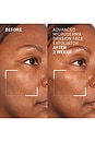 view 5 of 8 Advanced Microdermabrasion Renewing Face Exfoliator in 