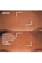 view 6 of 8 Advanced Microdermabrasion Renewing Face Exfoliator in 