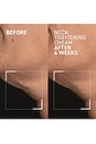 view 6 of 6 Needles No More Neck Tightening Cream With Gua Sha in 