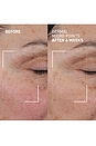 view 10 of 11 Dermal Micro Point Serum in 