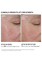 view 6 of 11 Dermal Micro Point Serum in 