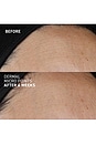 view 9 of 11 Dermal Micro Point Serum in 