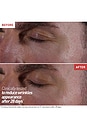 view 8 of 10 Skin Therapy Eye in 