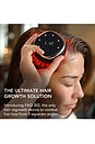 view 4 of 9 FAQ 302 Laser & LED Hair Regrowth Scalp Massager in Black Diamond