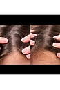 view 9 of 9 FAQ 302 Laser & LED Hair Regrowth Scalp Massager in Black Diamond