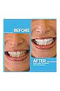 view 3 of 3 Teeth Whitening Gel in 