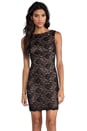 view 1 of 6 Lace Dress in Black/Suntan in Black & Suntan