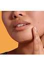 view 4 of 6 Mighty Patch Chin Pimple Patch 10 Count in 
