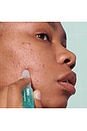 view 4 of 6 Pimple Correct Acne Clearing Gel Pen in 