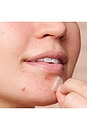 view 5 of 6 PARCHE DE ESPINILLAS PIMPLE PATCH in 
