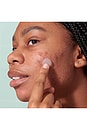 view 6 of 6 PARCHE DE ESPINILLAS PIMPLE PATCH in 