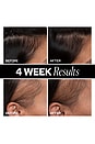 view 3 of 10 Sponsored Hair Density Scalp Treatment in 