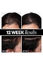 view 4 of 10 Sponsored Hair Density Scalp Treatment in 