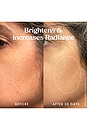 view 8 of 10 Star Bright Discoloration Correcting Serum in 