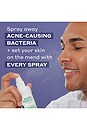 view 6 of 6 SPRAY FACIAL REPAIRING in 