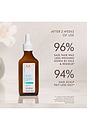 view 4 of 5 Oily Scalp Treatment in 