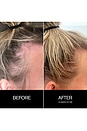 view 7 of 8 Follicle Drops in 