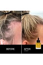 view 7 of 10 Scalp Treatment Set in 