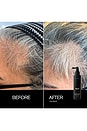 view 9 of 10 Scalp Treatment Set in 