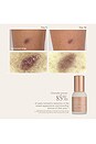 view 7 of 8 Complex Scar Serum in 
