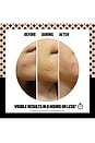 view 3 of 10 PATCHES PARA ESPINHAS SALICYLIC ACID ACNE HEALING DOTS 20 DOTS in 