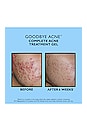 view 7 of 7 Full-Size Goodbye Acne Acne Treatment Pair 2-Piece Kit in 
