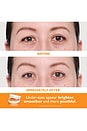 view 3 of 7 Vitamin C & Hyaluronic Acid Eye Patches in 