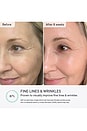view 2 of 10 Q-Rejuvalight Pro Facewear LED Mask in 