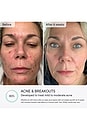 view 3 of 10 Q-Rejuvalight Pro Facewear LED Mask in 
